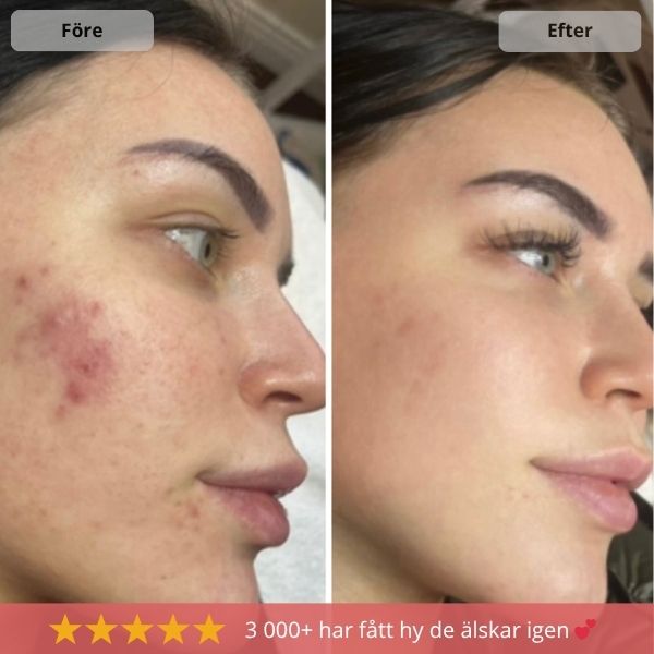 LuxeClean Borsterenare